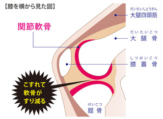 1i-dr_-Gynl1311)z.jpg